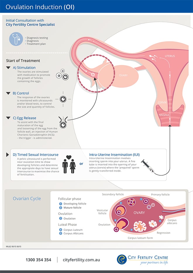 Ovulation Induction Fertility Treatment City Fertility Centre