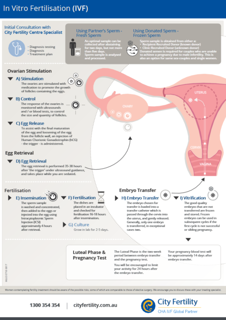IVF Fertility Treatment Process | City Fertility