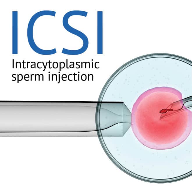 ICSI - A Beginner's Guide | City Fertility