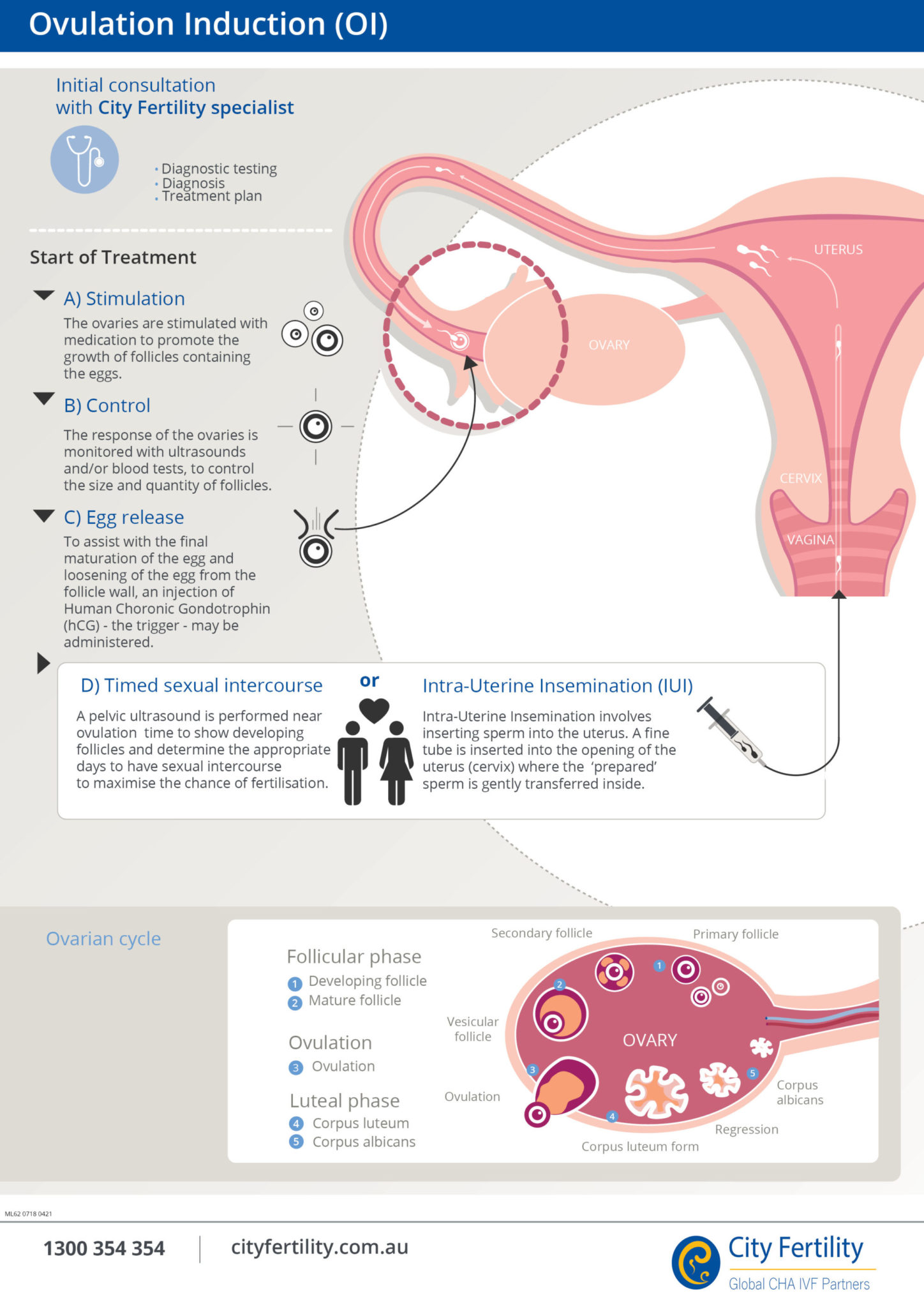 Ovulation Induction Fertility Treatment City Fertility 2563