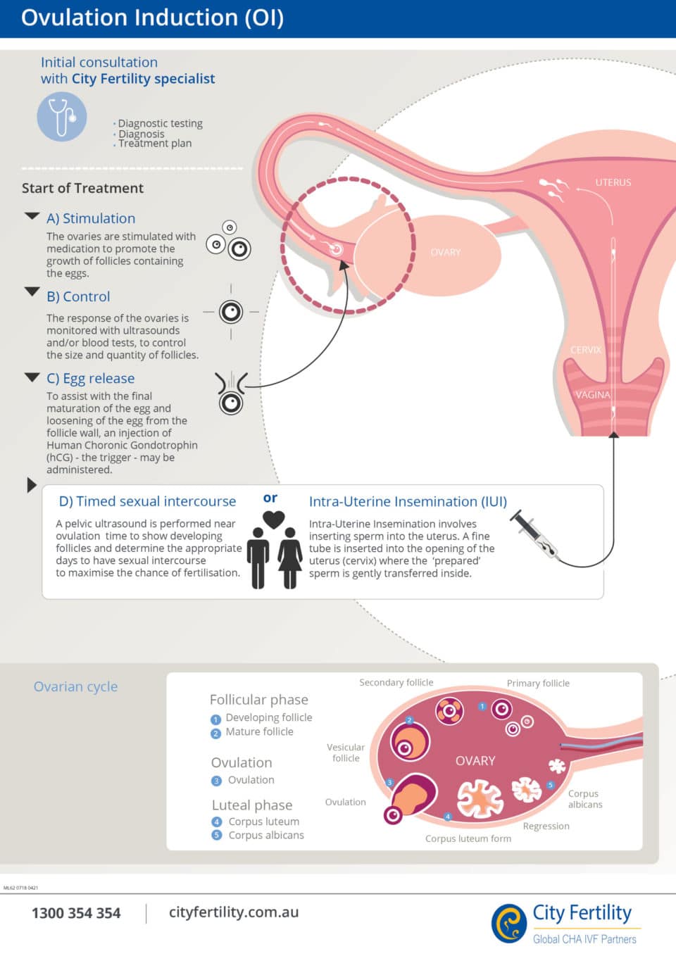 Ovulation Induction Fertility Treatment | City Fertility