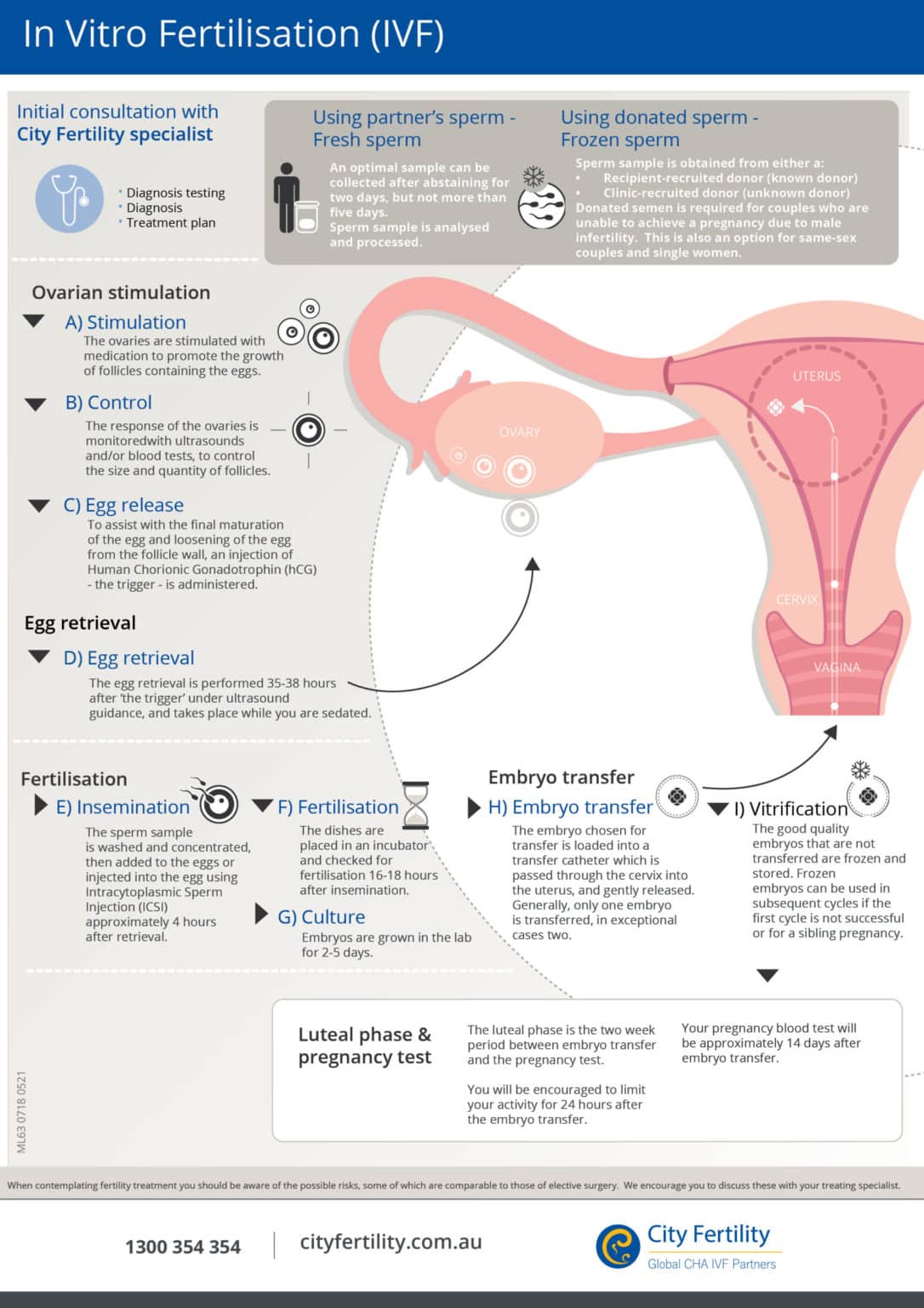 IVF Fertility Treatment Process | City Fertility