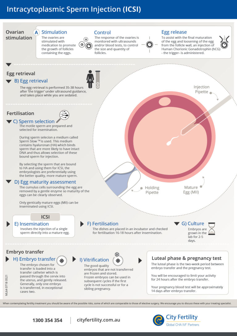 Icsi Intracytoplasmic Sperm Injection City Fertility 7622