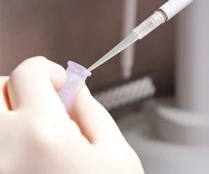 Sperm Test Semen Analysis City Fertility Centre